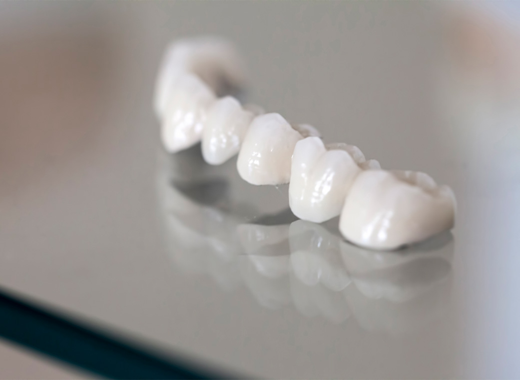 オールセラミック