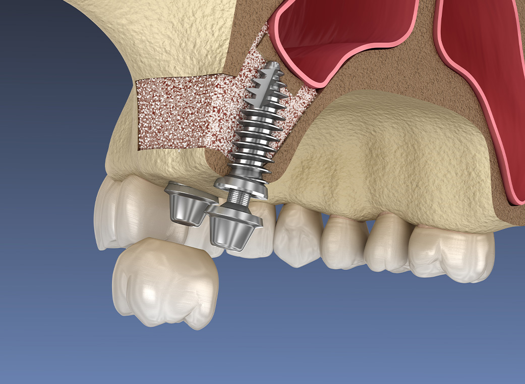 治療期間が長い