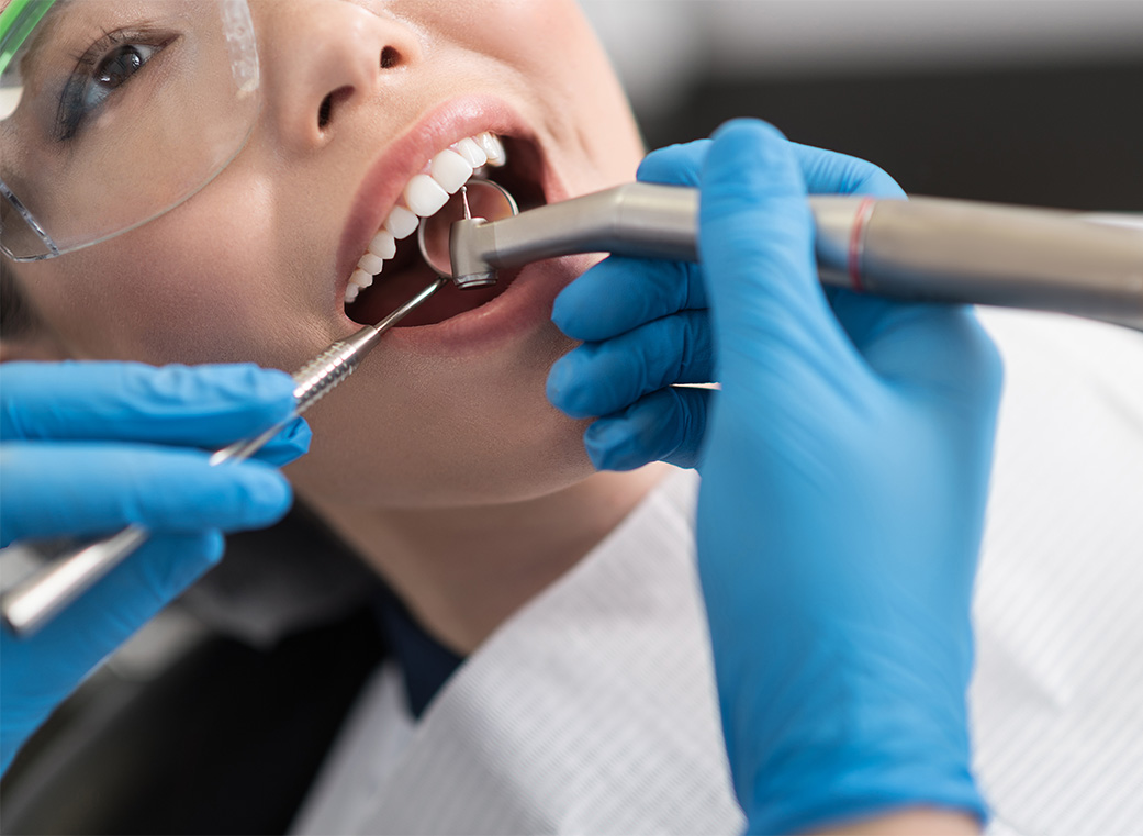 当院のむし歯治療の特徴