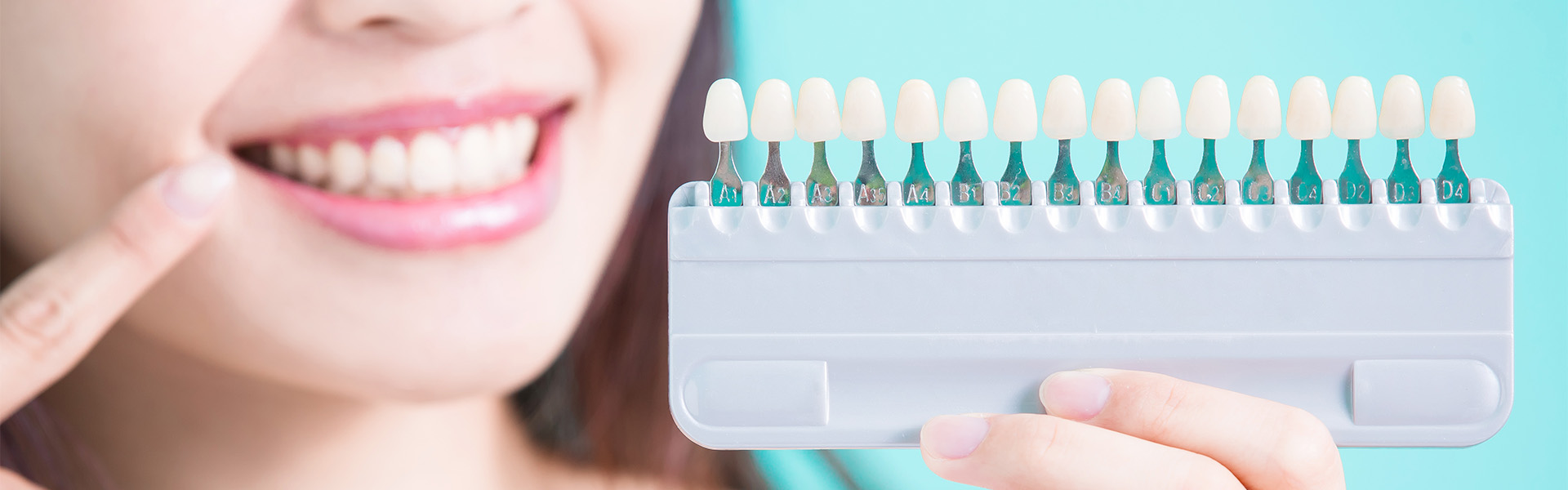 ホワイトニング