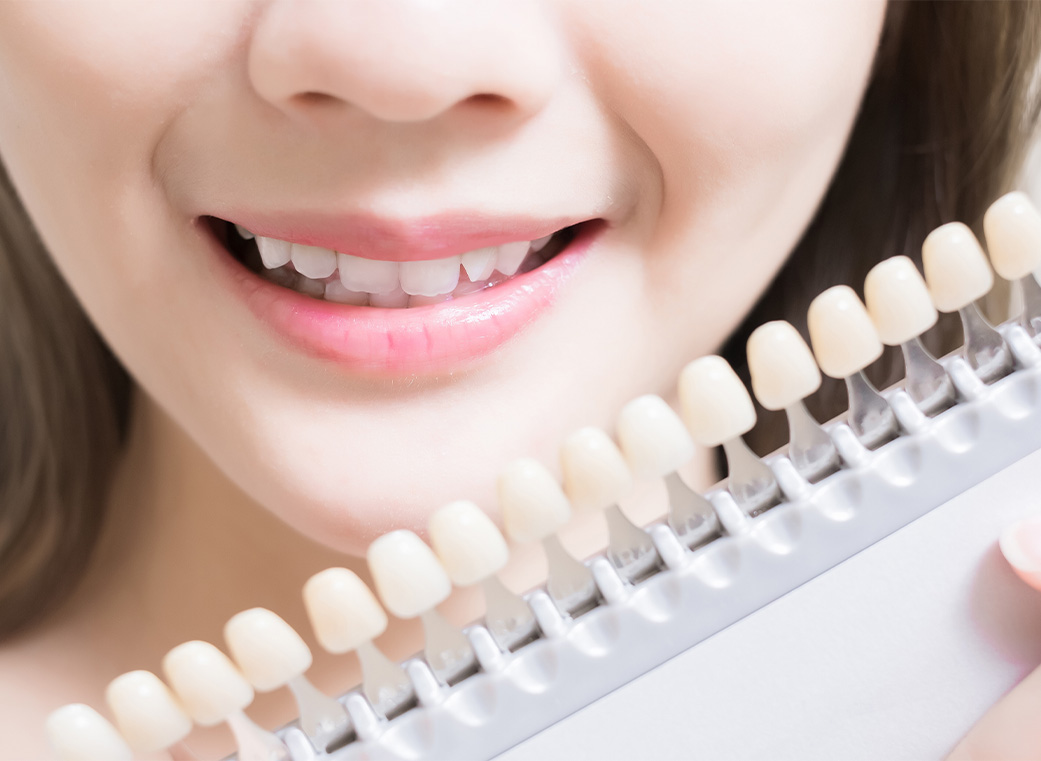 ホワイトニングで理想の白い歯へ
