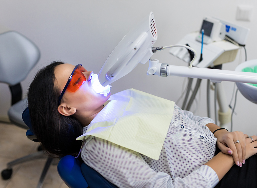 Step 05 オフィスホワイトニングの場合